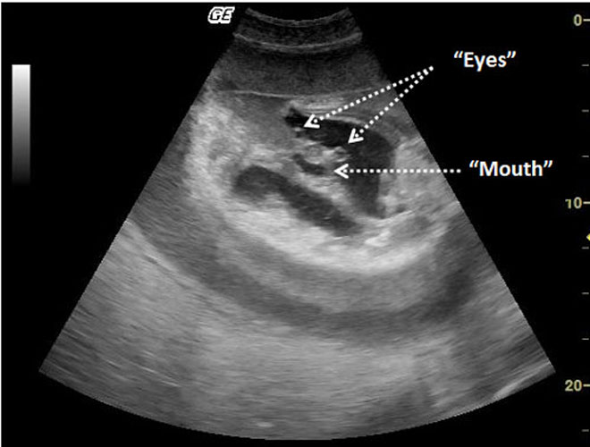 Ultrasound of a developing Black blotched fantail ray.
